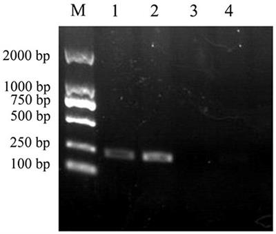 YbfA Regulates the Sensitivity of Escherichia coli K12 to Plantaricin BM-1 via the BasS/BasR Two-Component Regulatory System